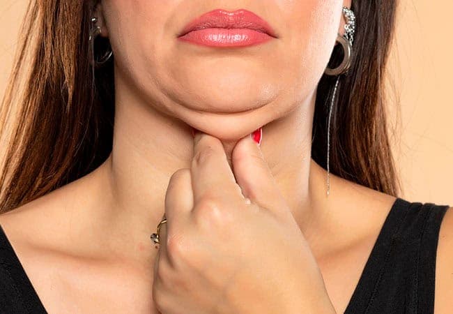 Double chin removal treatments at 99 Medispa Sydney