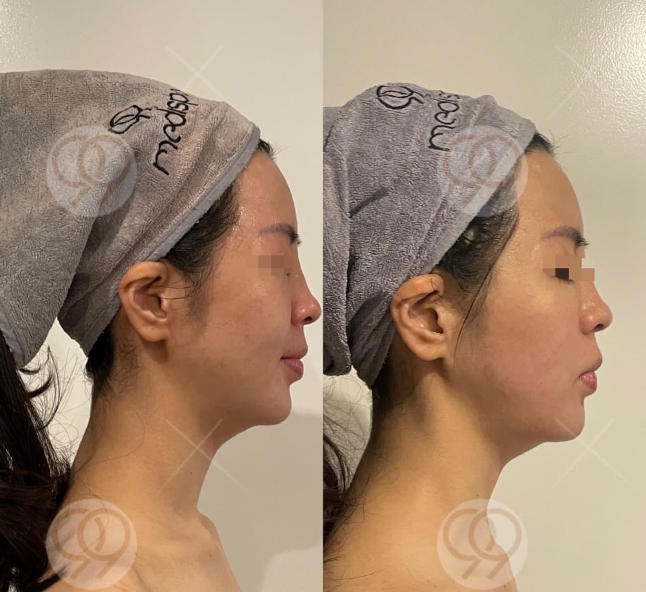 Before & After Transformations 10