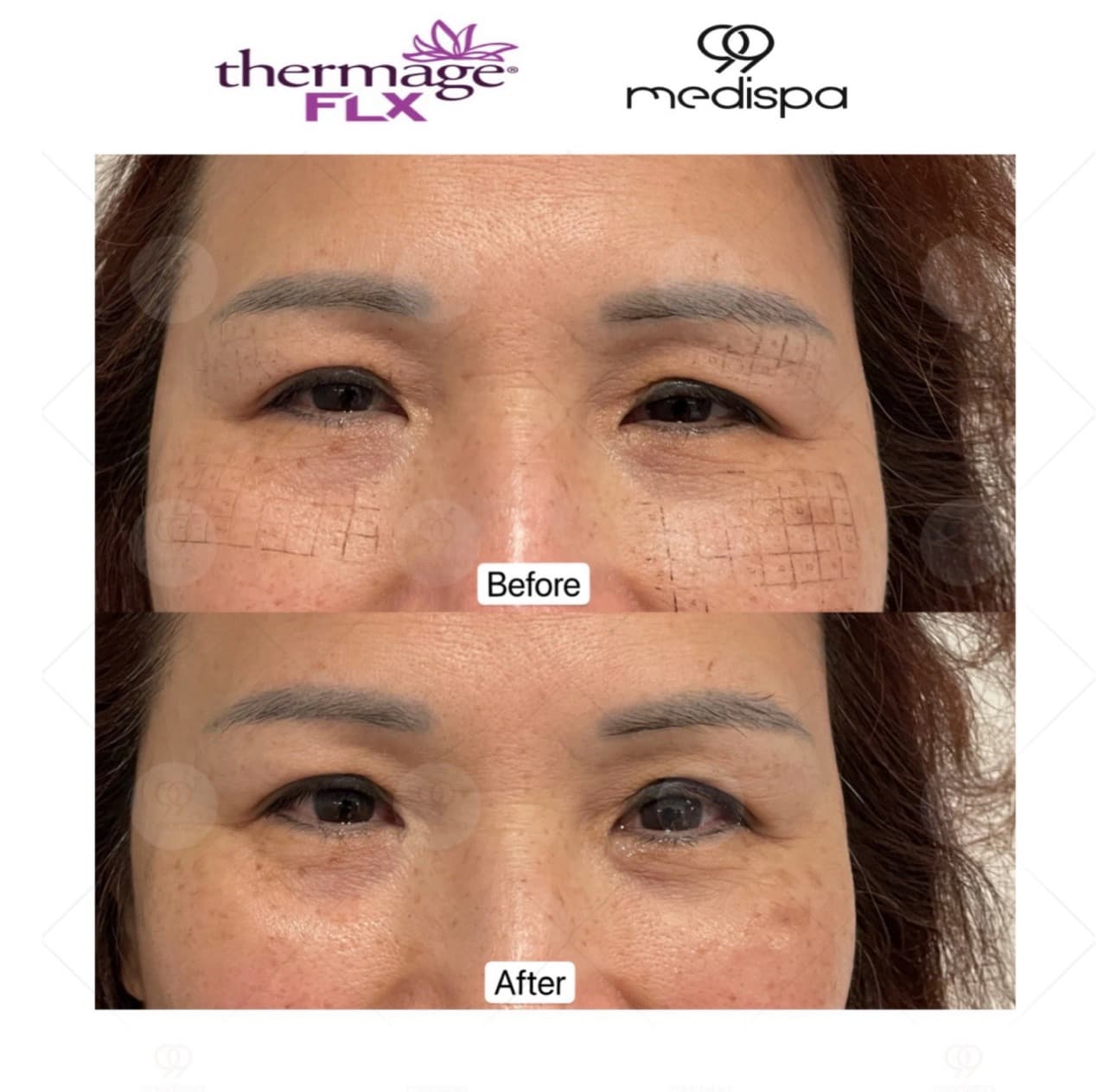 Before & After Transformations 8