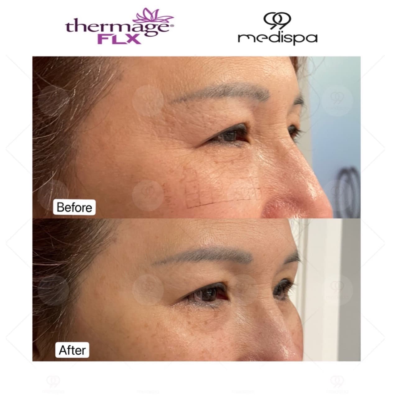 Before & After Transformations 9
