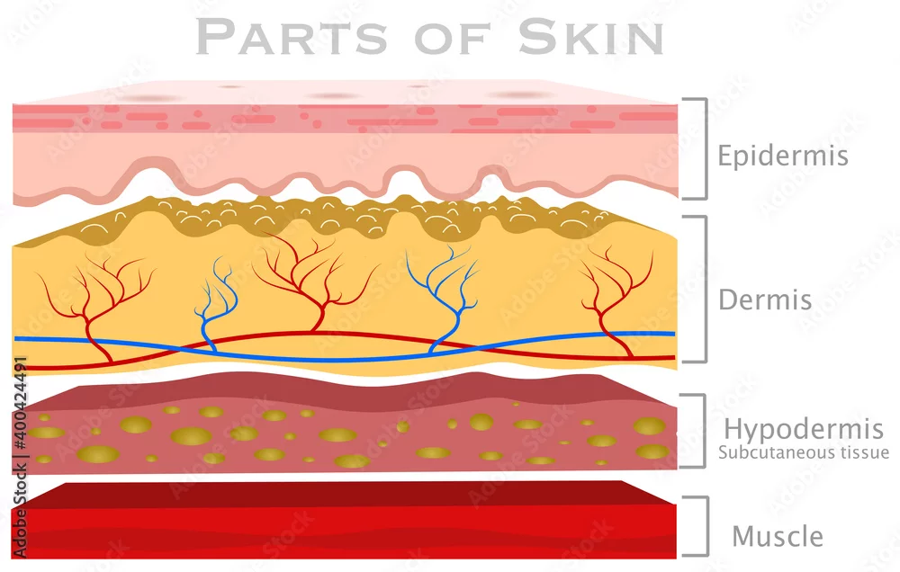 Diagram showing the four layers of skin — epidermis, dermis, hypodermis and muscle