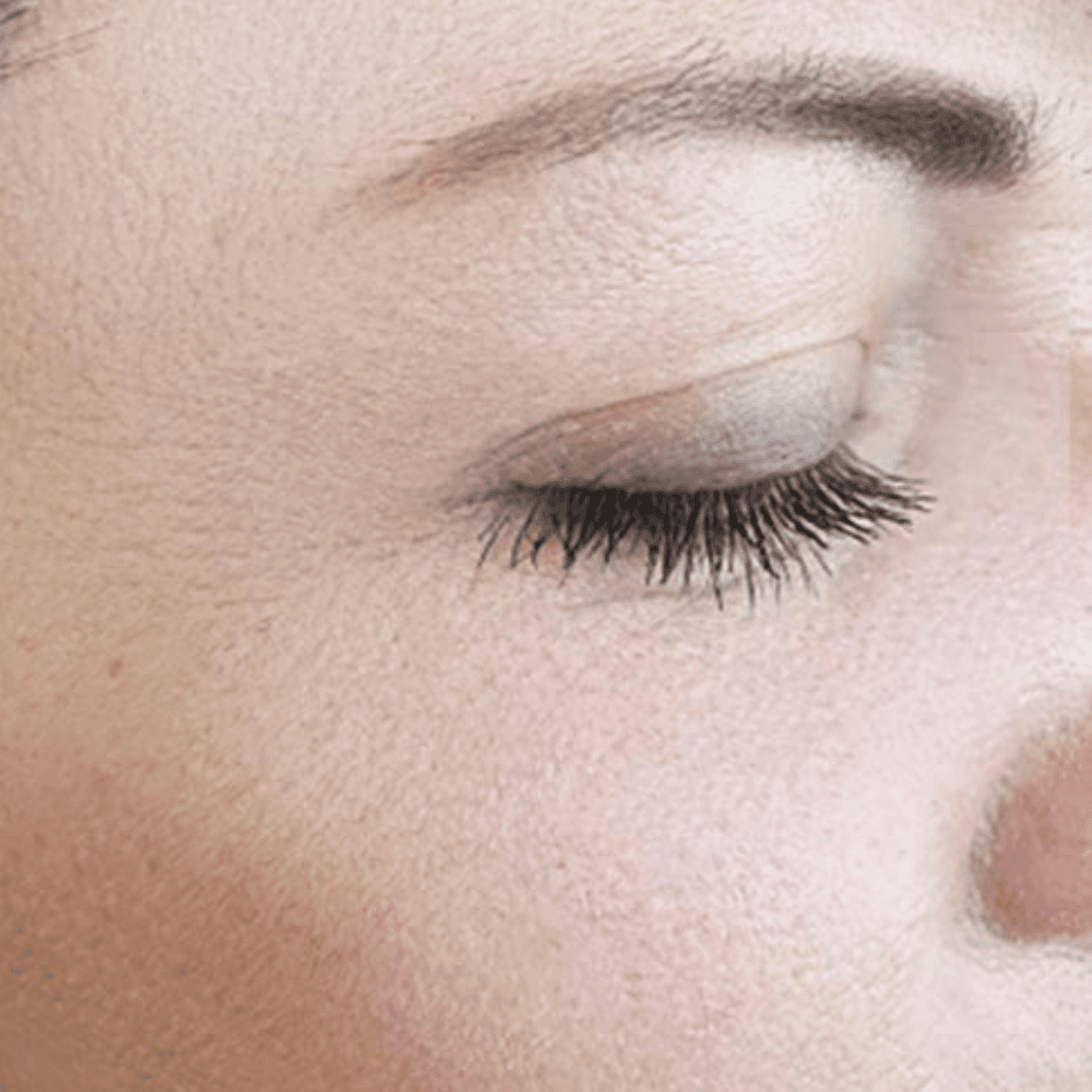 Rejuran before and after results 1 - After